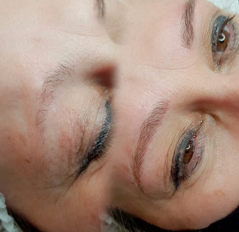 Foto exemplo Microblading Fio a Fio Reconstrução Sobrancelhas